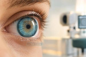 Ocular Surface Optimization: Key Pre-Surgery Steps